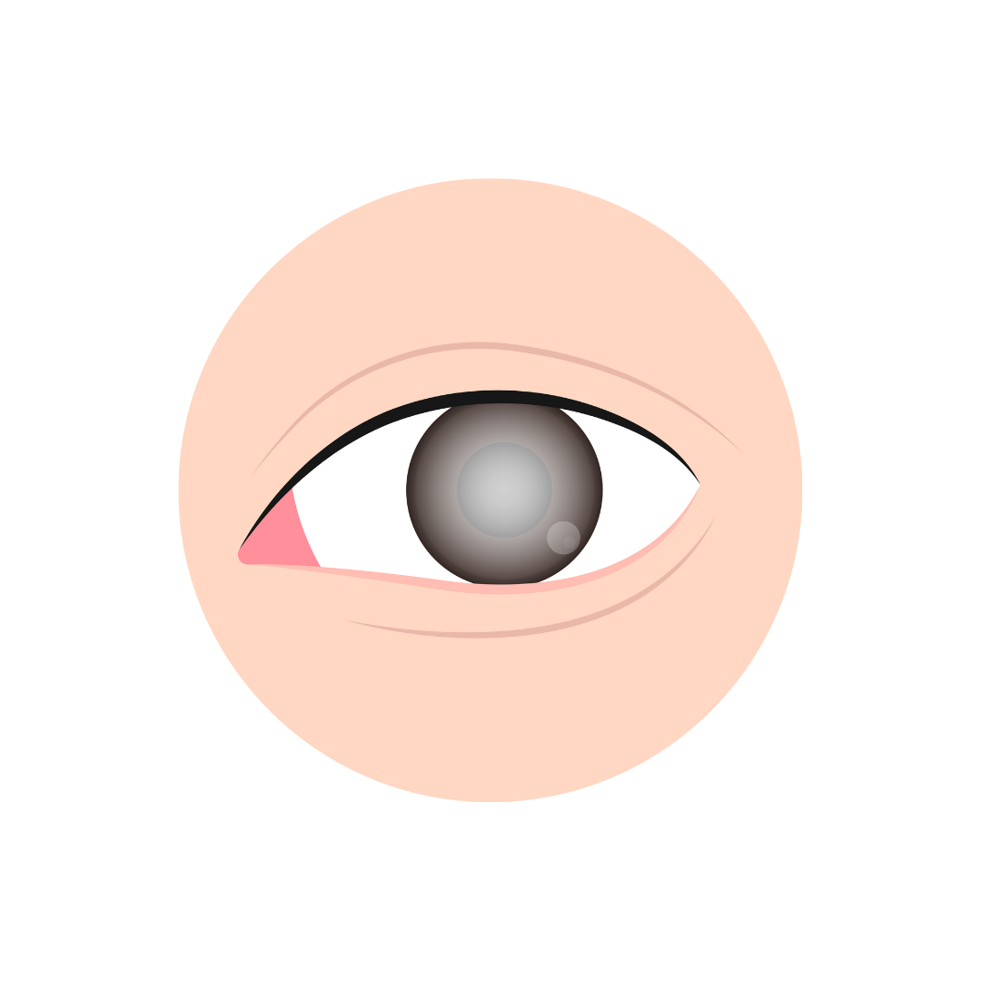 Eye & Vision Support