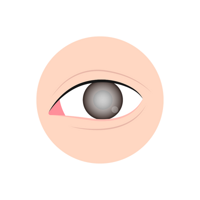 Eye &&nbsp;Vision Support